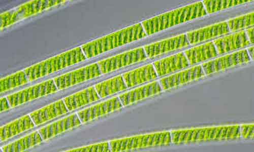 image of Spirogyra