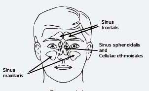 image of sinuses(Sinusitis)