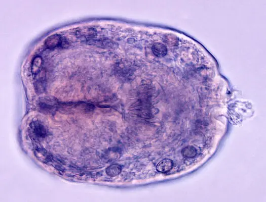 echinococcus-granulosus-morphology-life-cycle-and-pathogenesis-biology-educare