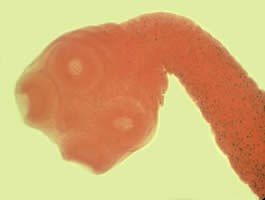 image of Scolex of T saginata