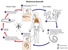 Wuchereria bancrofti: Morphology, Life Cycle and Pathogenesis | Biology ...