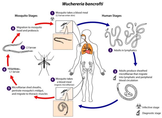 Wuchereria bancrofti: Morphology, Life Cycle and Pathogenesis | Biology ...