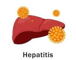 Hepatitis